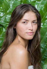 Botox, restylane, juvederm, Aspect Dr, Results RX